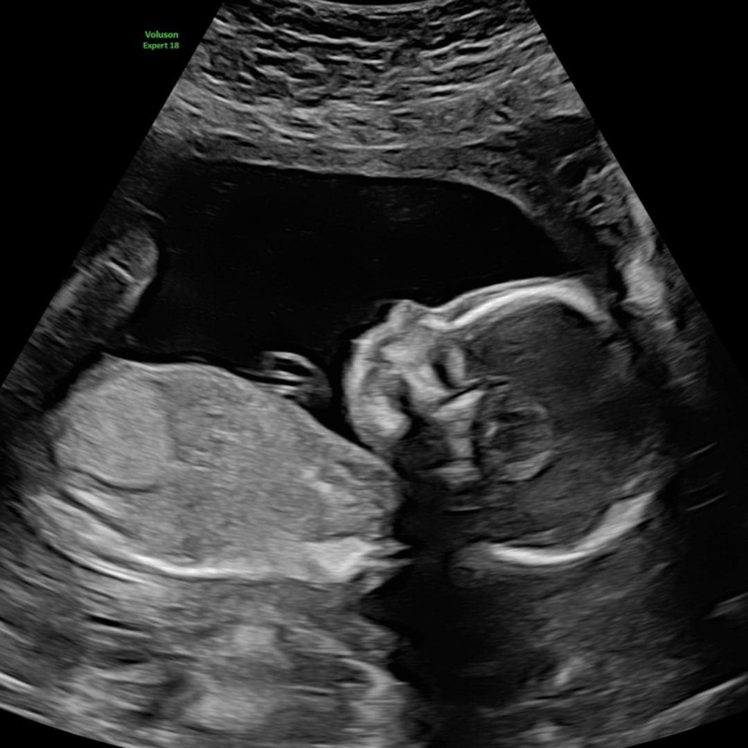 Photo shared by Kayla for their Babylist baby registry.