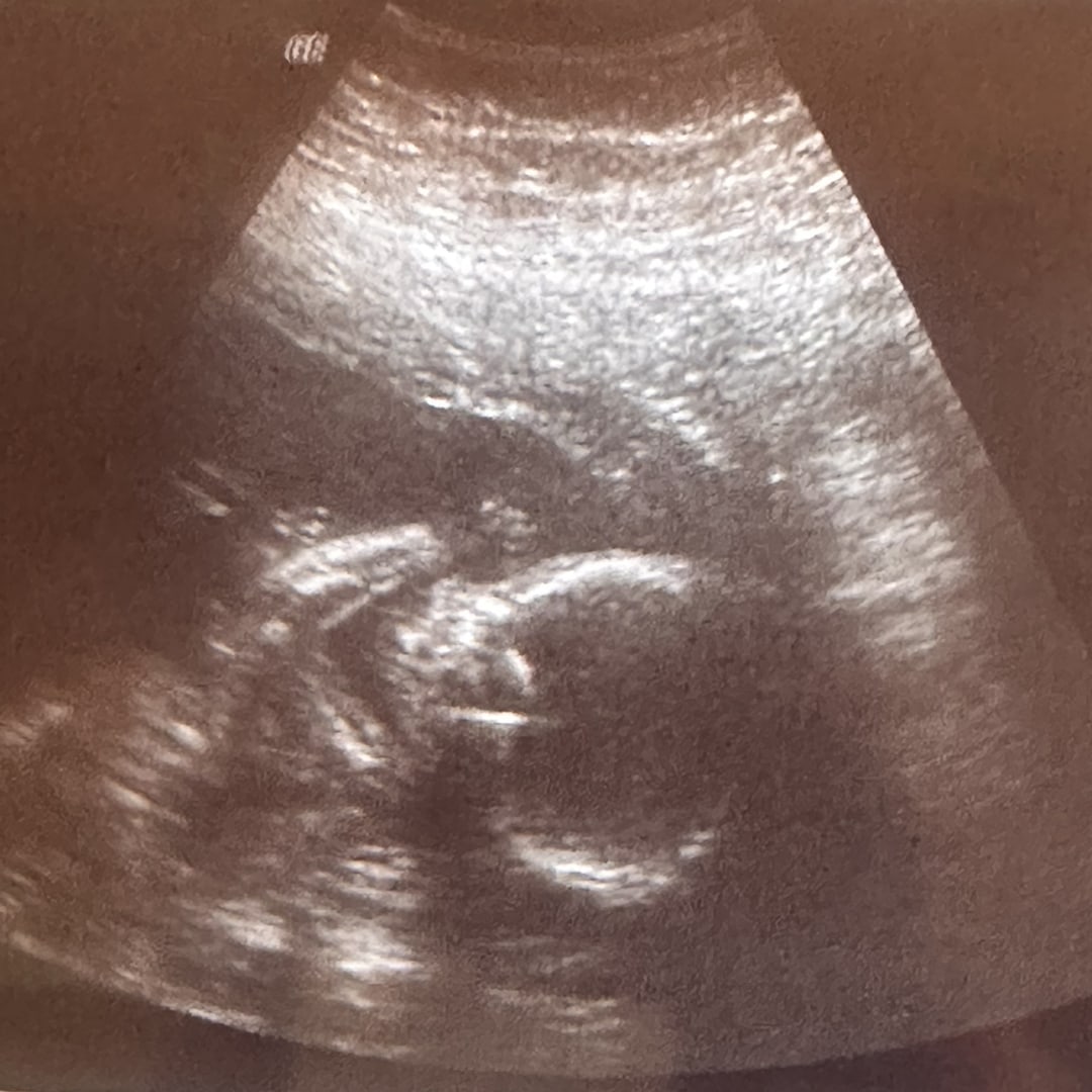 Photo shared by Christina for their Babylist baby registry.
