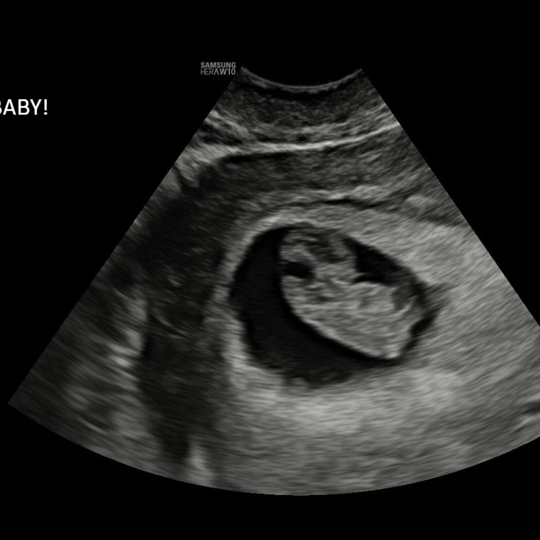 Photo shared by Amber for their Babylist baby registry.