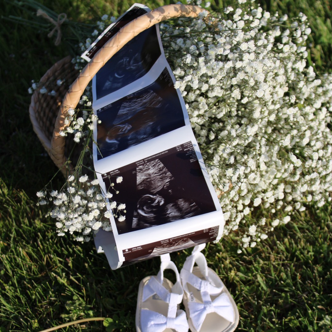 Photo shared by Zaira for their Babylist baby registry.