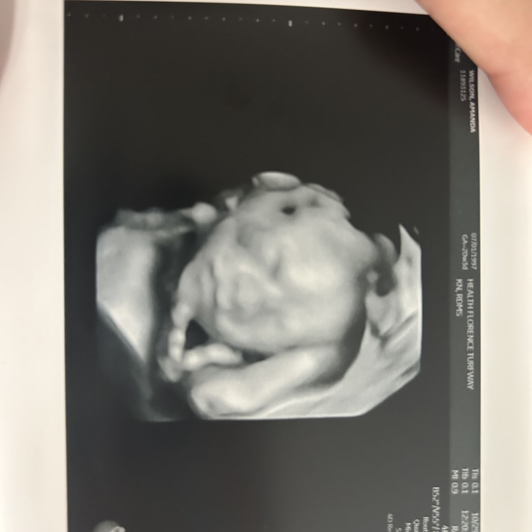 Photo shared by Amanda for their Babylist baby registry.