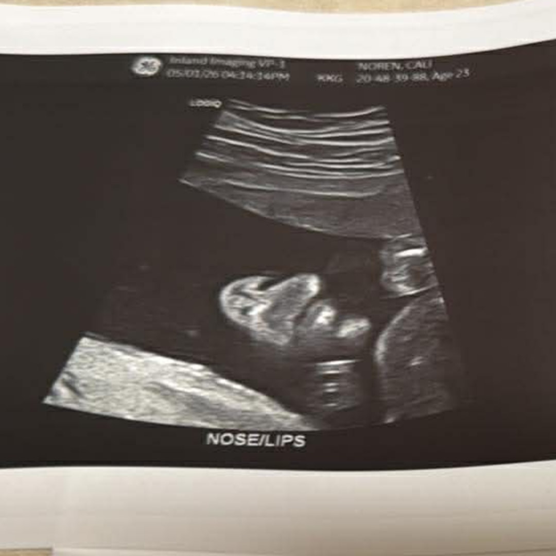 Photo shared by Cali for their Babylist baby registry.