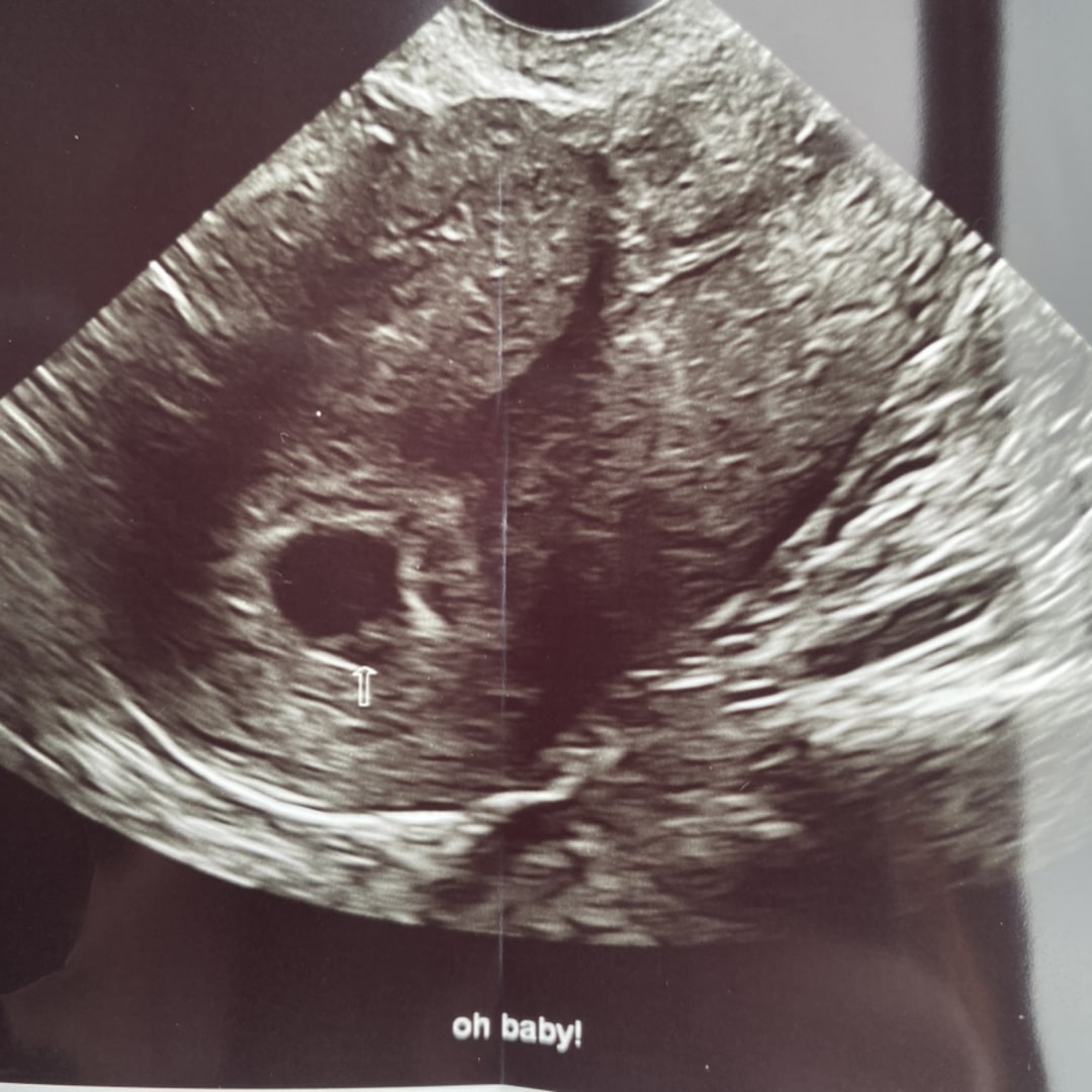 Photo shared by Robin for their Babylist baby registry.