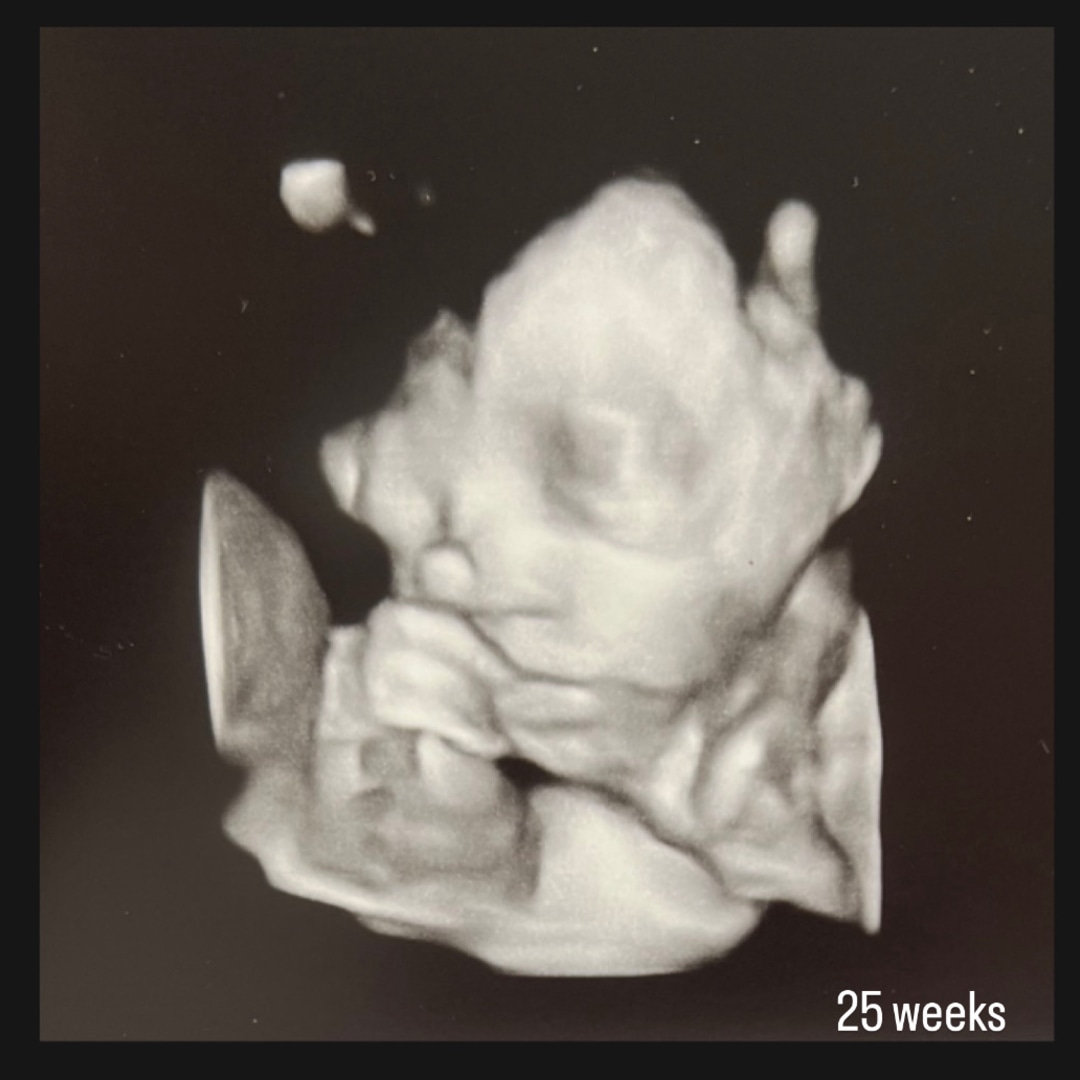 Photo shared by Brittany for their Babylist baby registry.