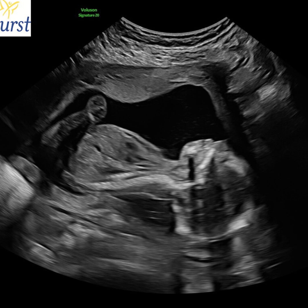 Photo shared by Carly for their Babylist baby registry.