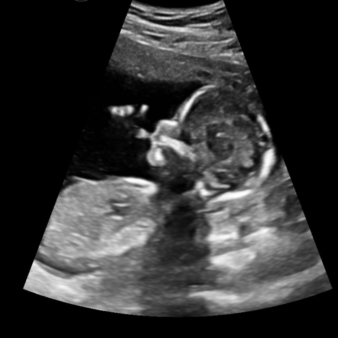 Photo shared by Gracy for their Babylist baby registry.