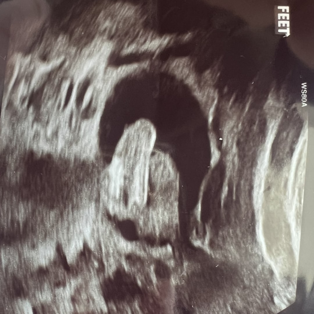 Photo shared by Rissa for their Babylist baby registry.