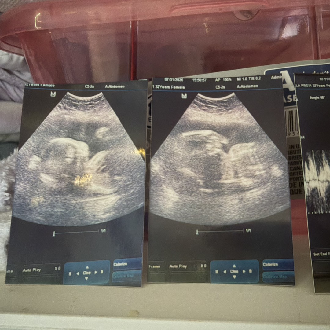 Photo shared by Angela for their Babylist baby registry.