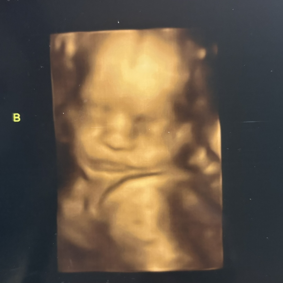 Photo shared by Hannah for their Babylist baby registry.