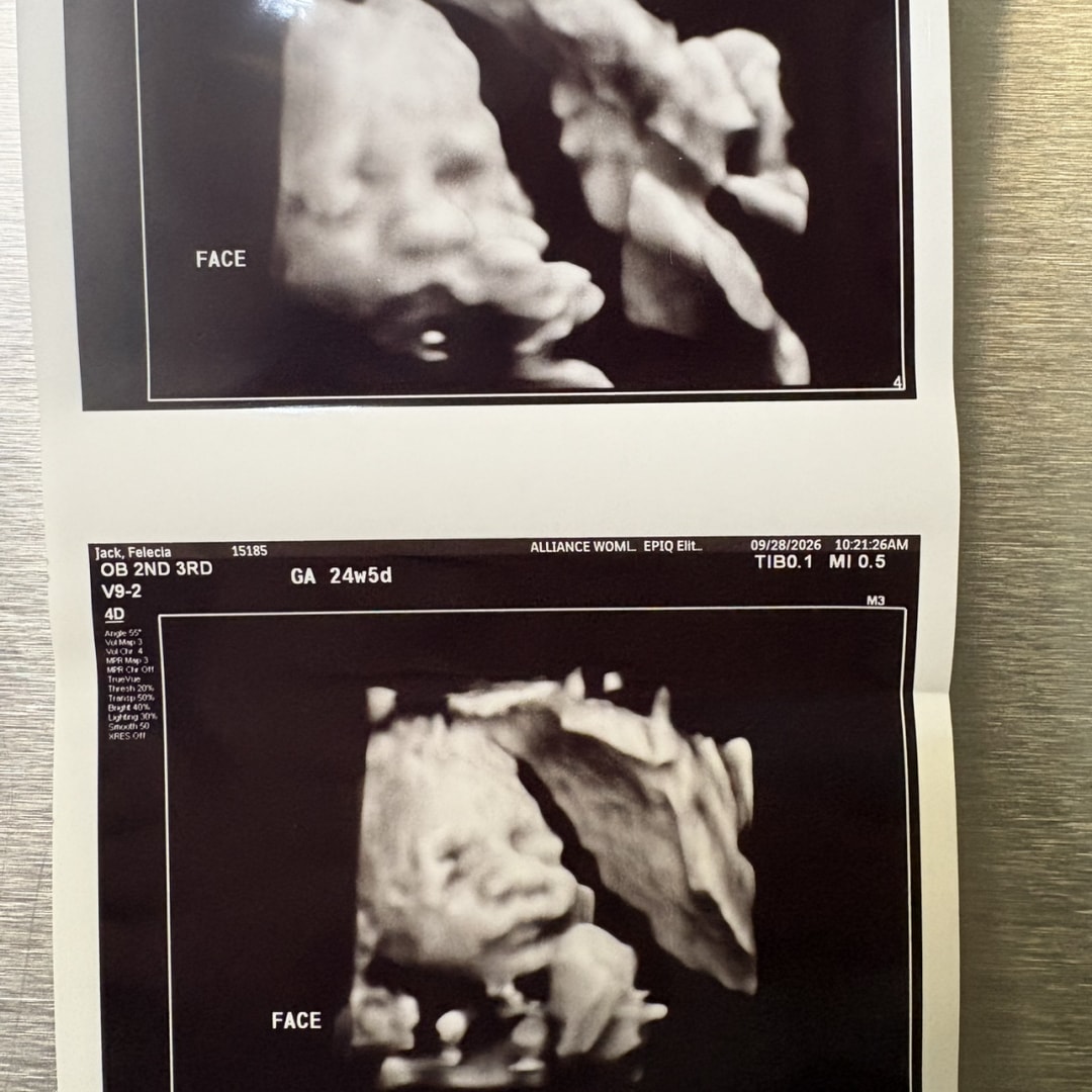 Photo shared by Felecia for their Babylist baby registry.