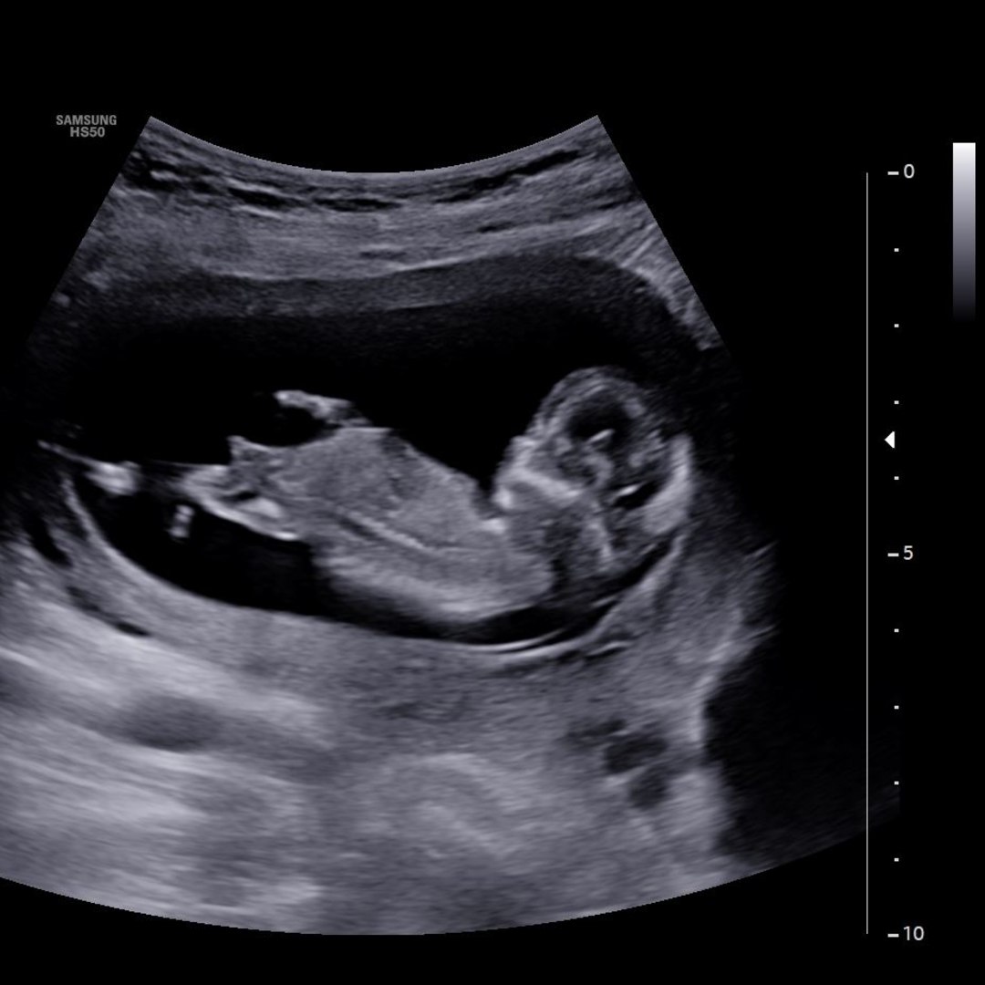 Photo shared by Kaitlyn for their Babylist baby registry.