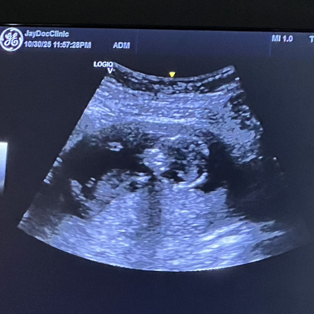 Photo shared by Tillie for their Babylist baby registry.