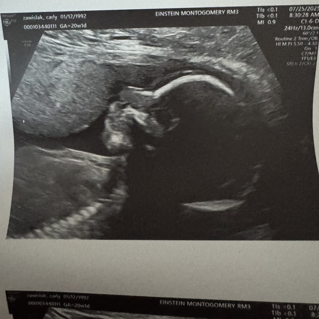 Photo shared by Carly for their Babylist baby registry.