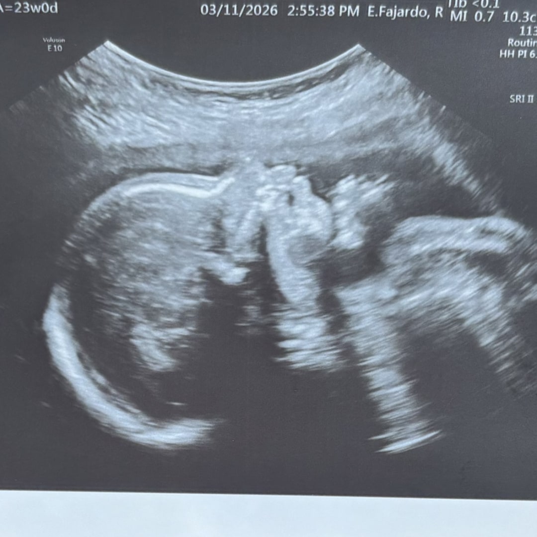 Photo shared by Nancy for their Babylist baby registry.