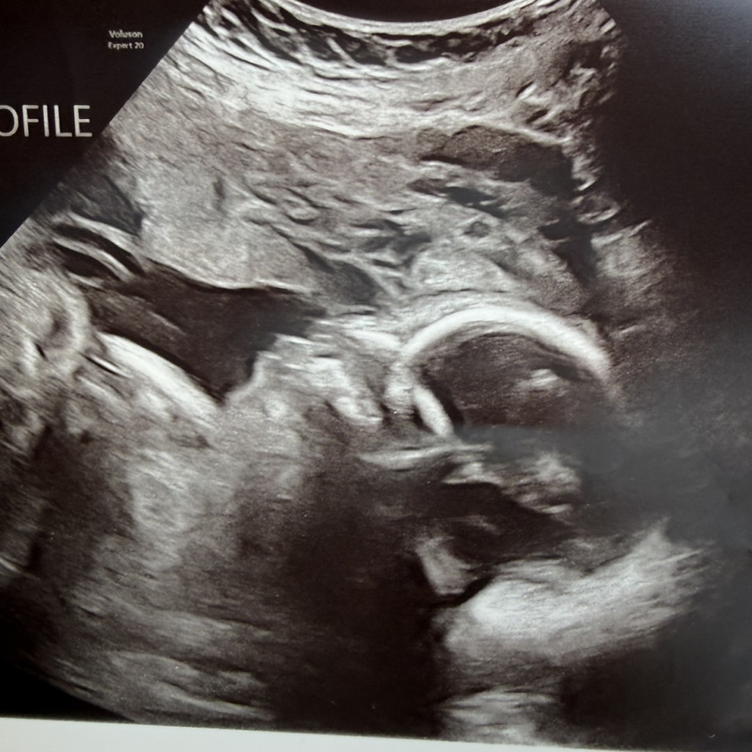 Photo shared by Angela for their Babylist baby registry.