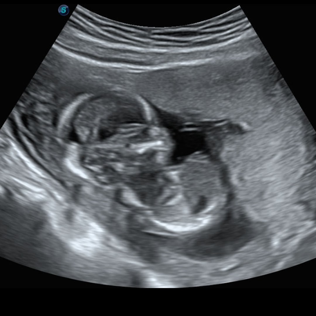 Photo shared by Katelynn for their Babylist baby registry.