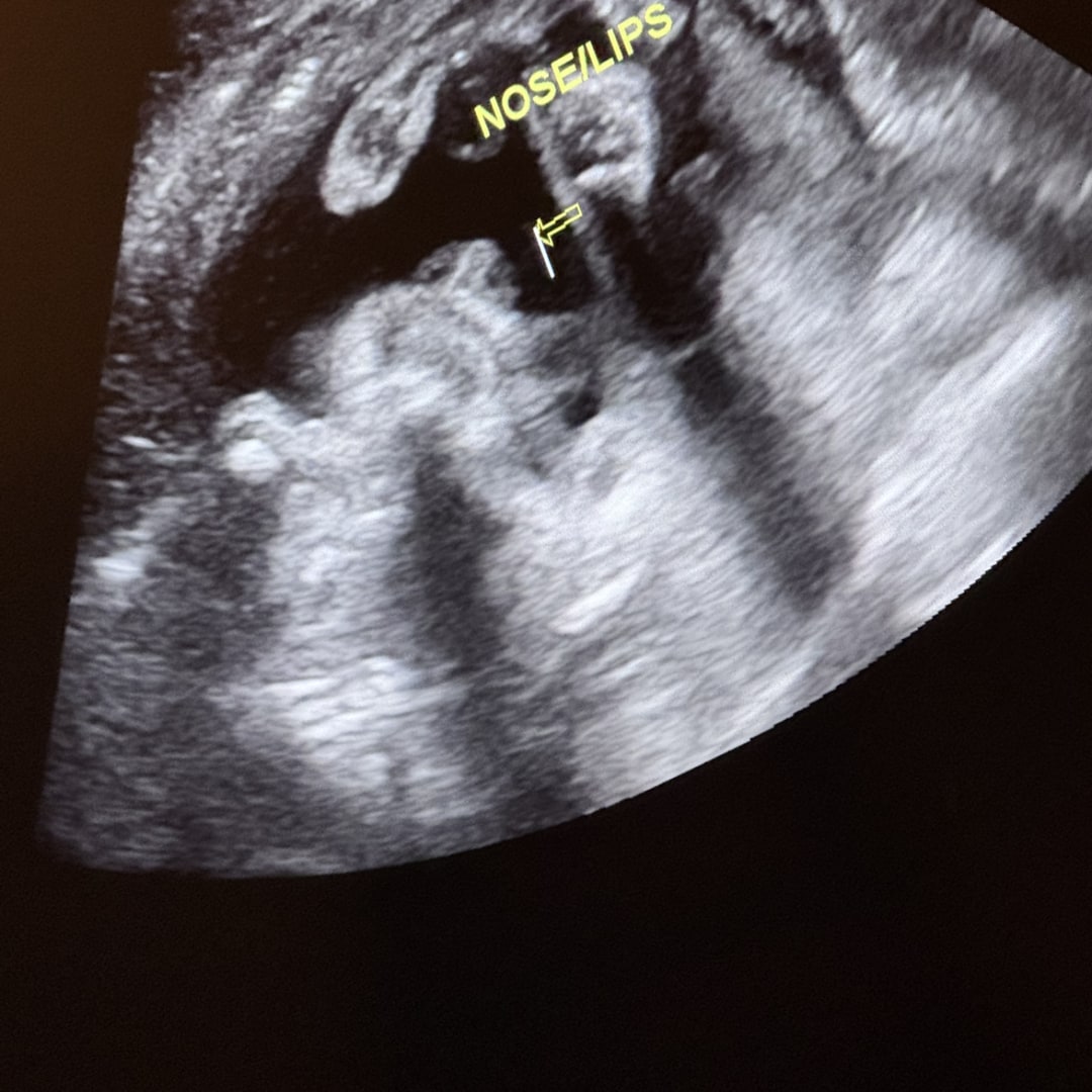 Photo shared by Felicia for their Babylist baby registry.