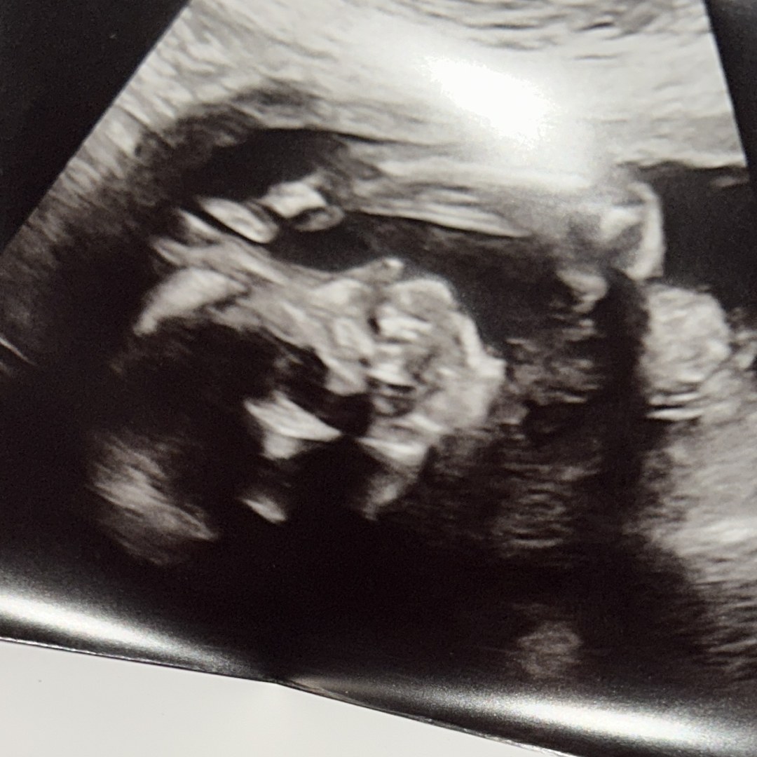 Photo shared by Cristina for their Babylist baby registry.