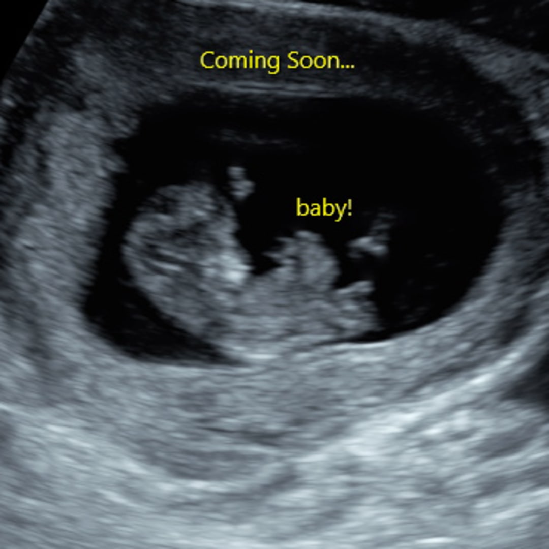 Photo shared by Cassie for their Babylist baby registry.