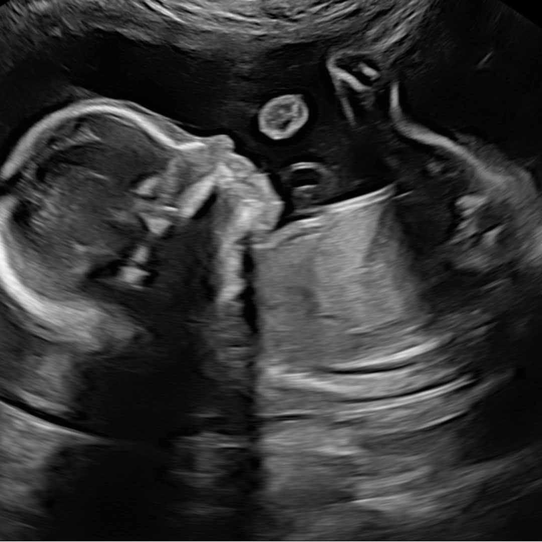 Photo shared by Taylor for their Babylist baby registry.