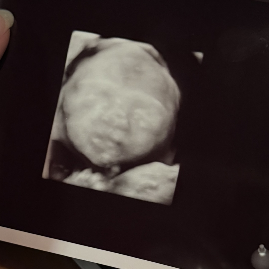 Photo shared by Azel for their Babylist baby registry.