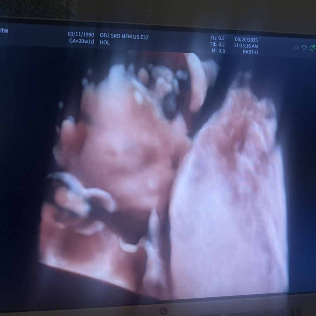 Photo shared by Judith for their Babylist baby registry.