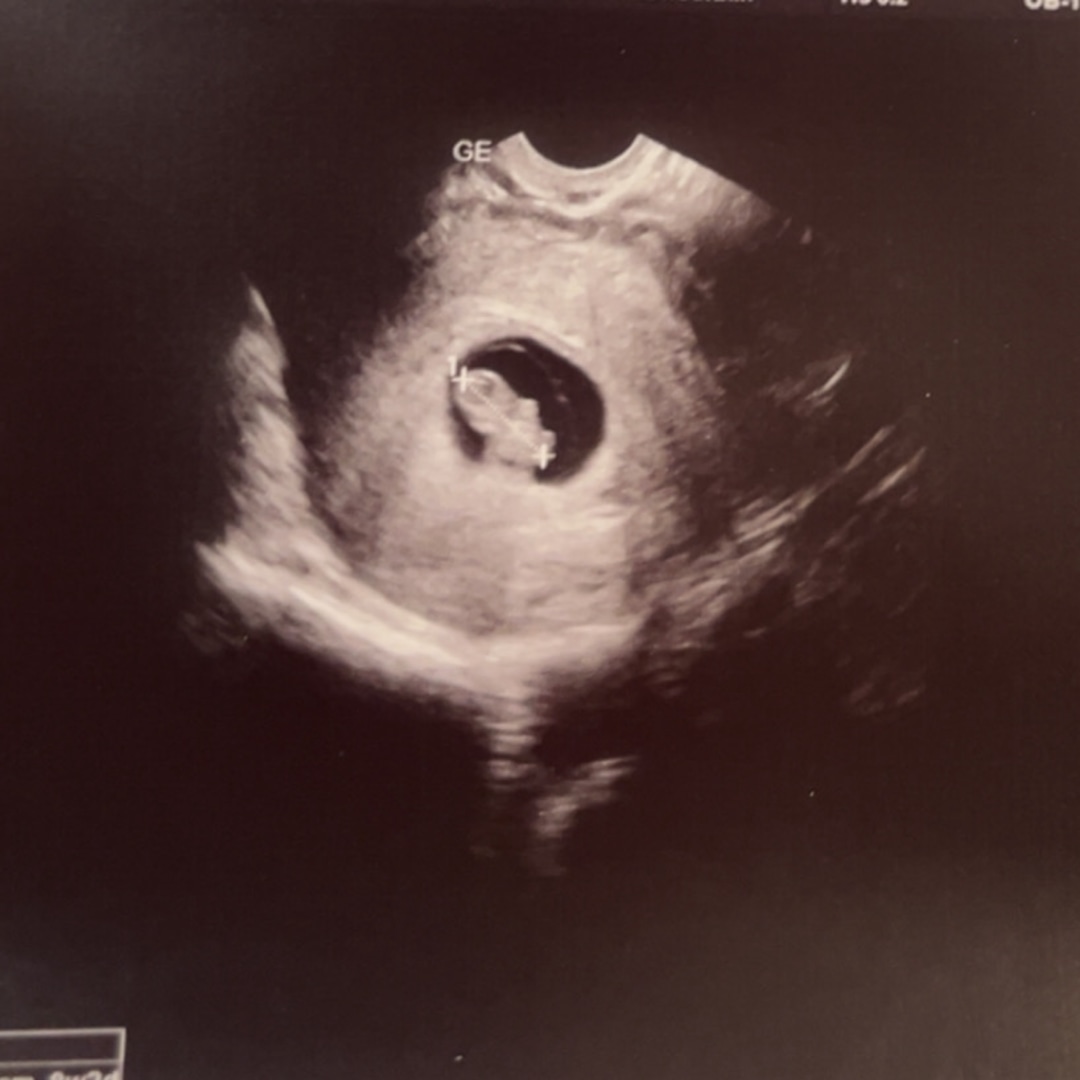 Photo shared by Ashlee for their Babylist baby registry.