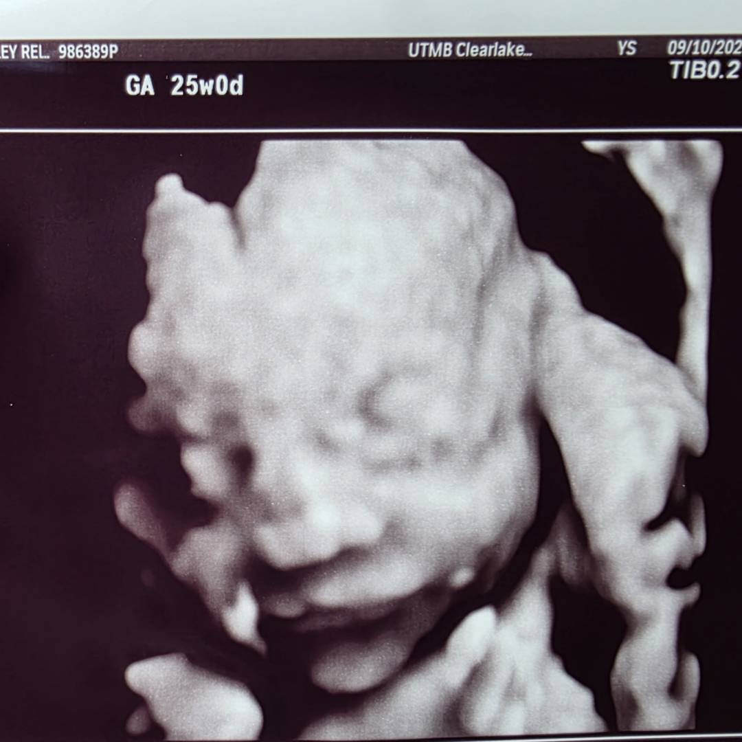 Photo shared by Ashley for their Babylist baby registry.