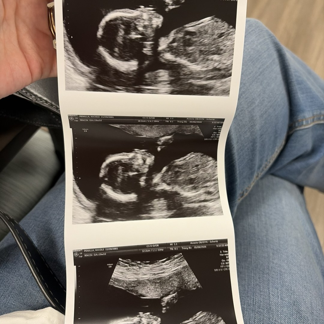Photo shared by Monserrat for their Babylist baby registry.