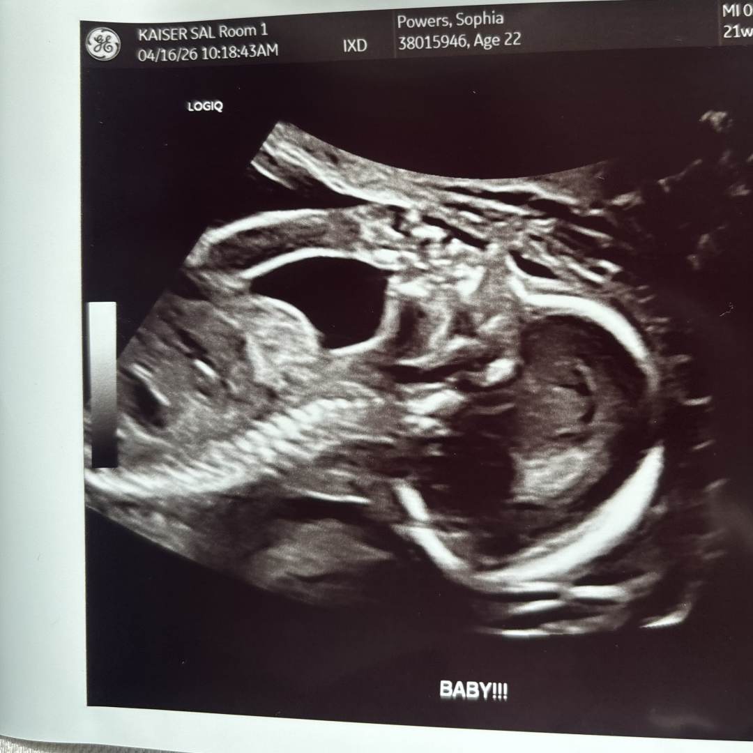 Photo shared by Sophia for their Babylist baby registry.