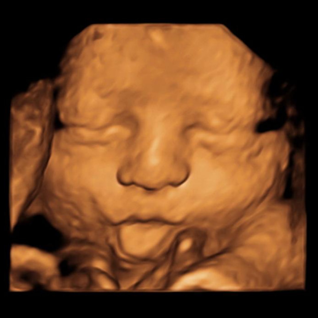 Photo shared by Denaya for their Babylist baby registry.