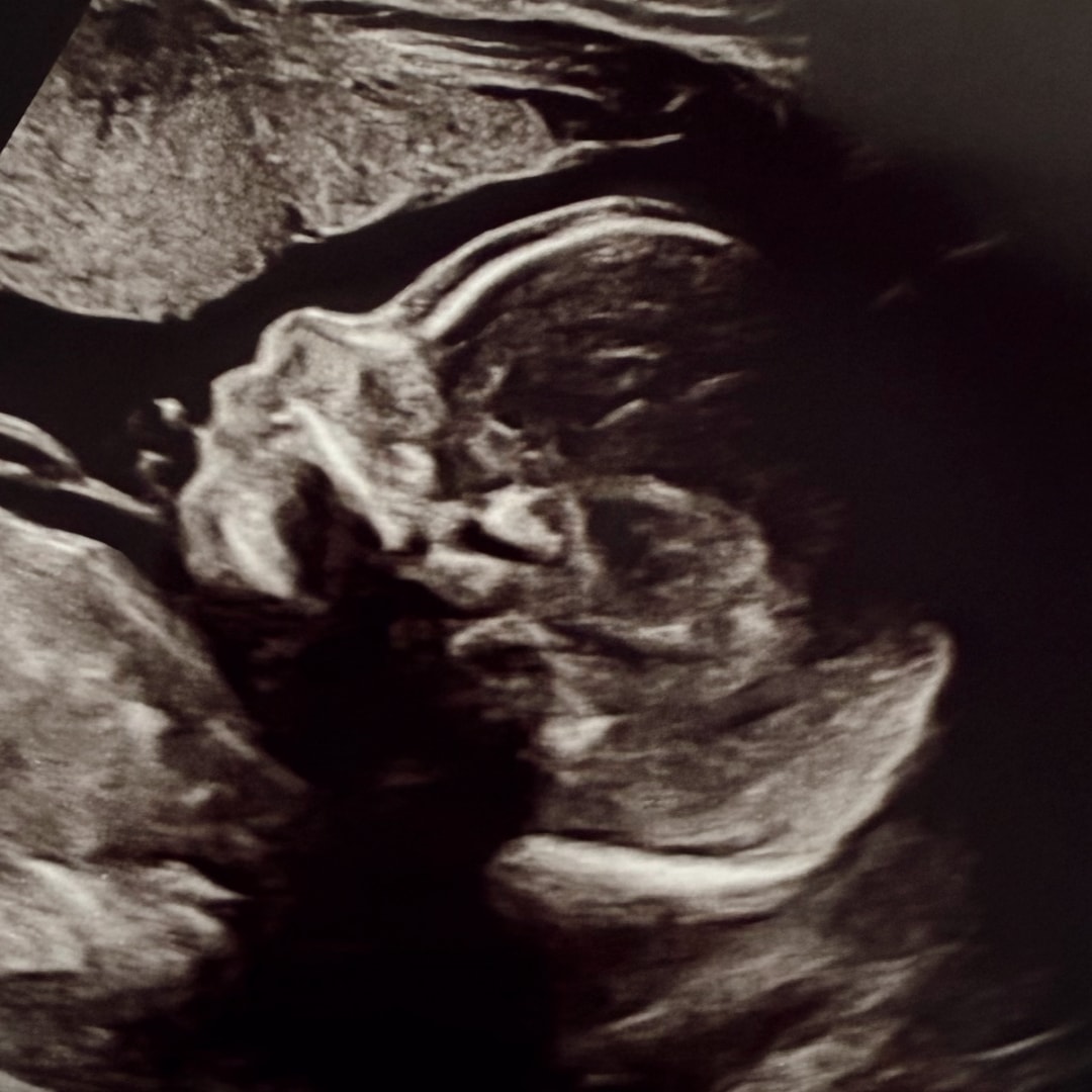Photo shared by Kelsey for their Babylist baby registry.