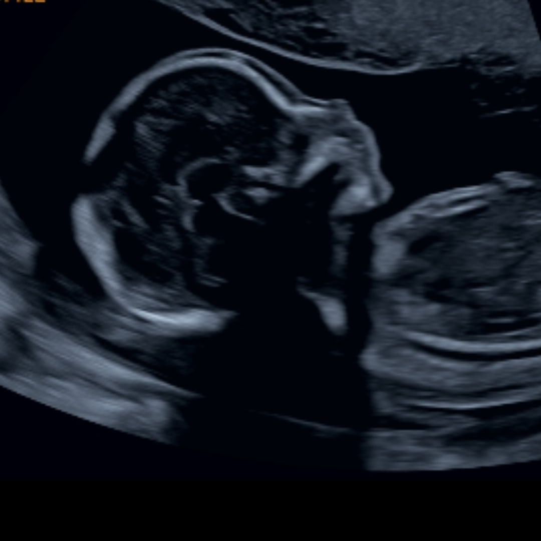 Photo shared by Logen for their Babylist baby registry.