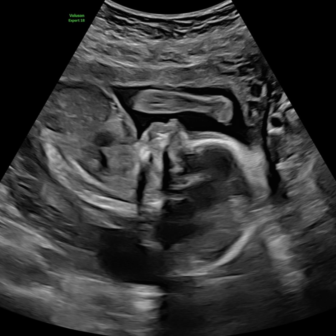 Photo shared by Jayli for their Babylist baby registry.