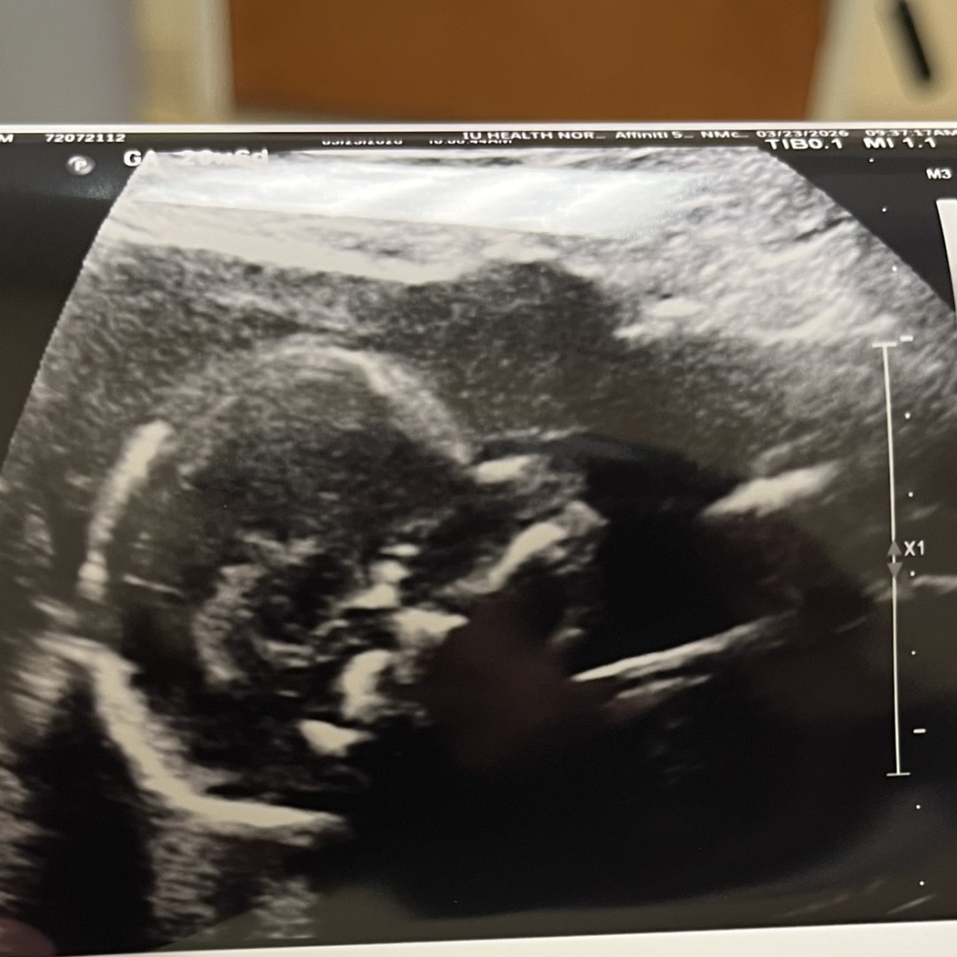 Photo shared by Allie for their Babylist baby registry.