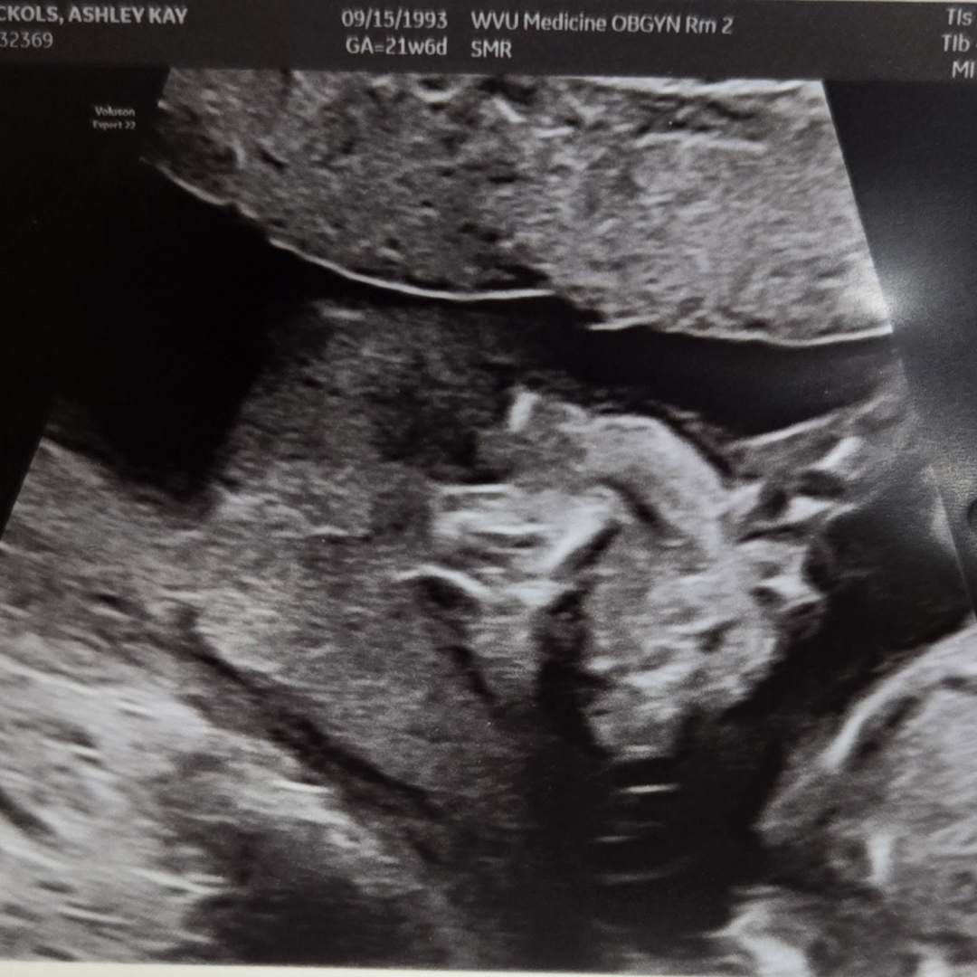 Photo shared by Ashley for their Babylist baby registry.