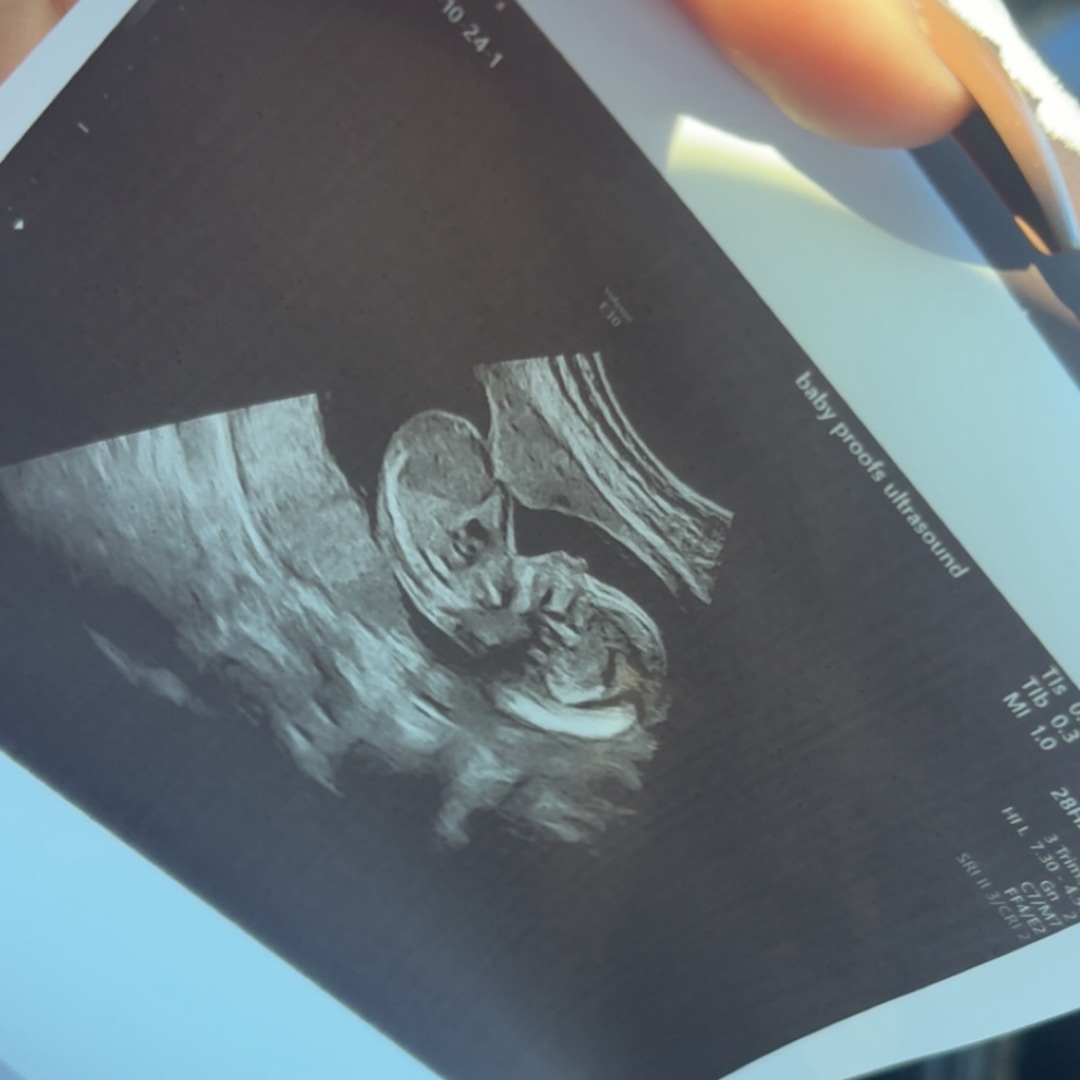 Photo shared by Jenna for their Babylist baby registry.