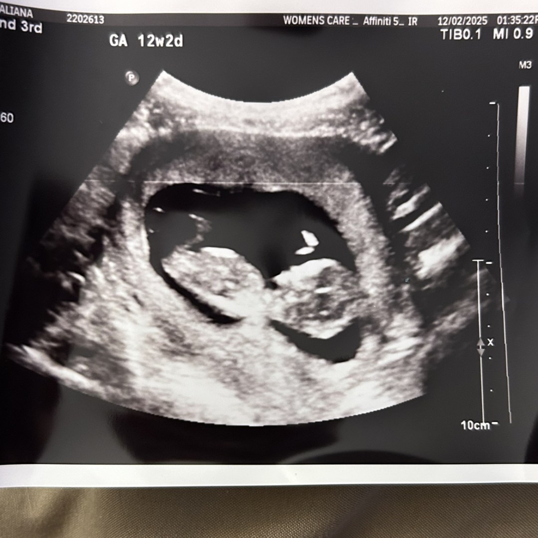 Photo shared by Aliana for their Babylist baby registry.