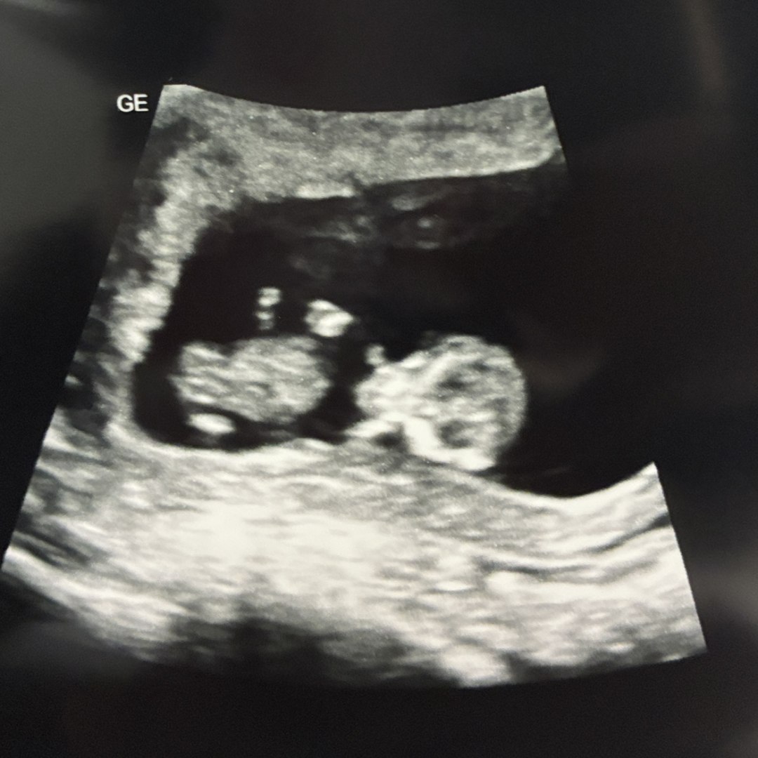 Photo shared by Daria for their Babylist baby registry.