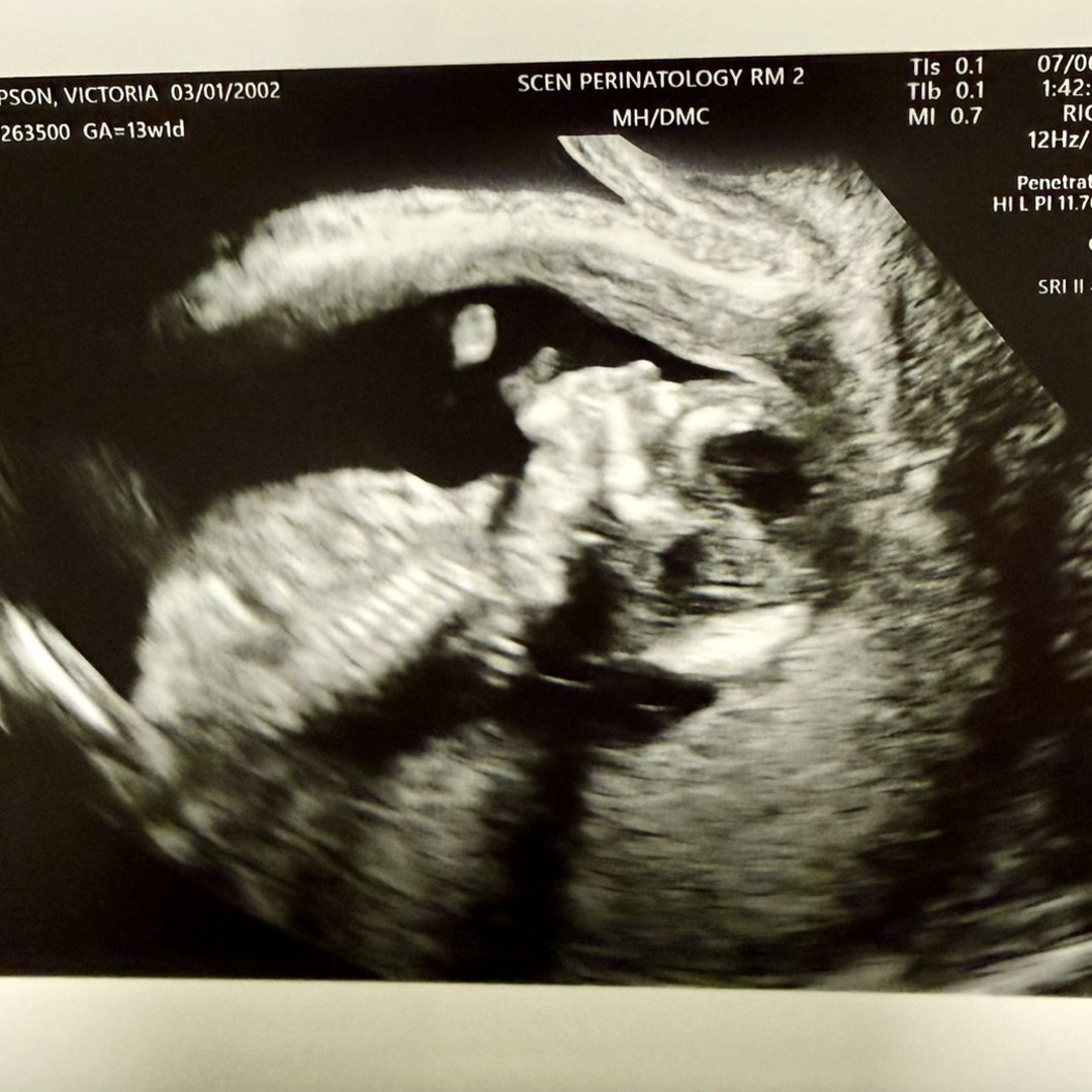 Photo shared by Victoria for their Babylist baby registry.
