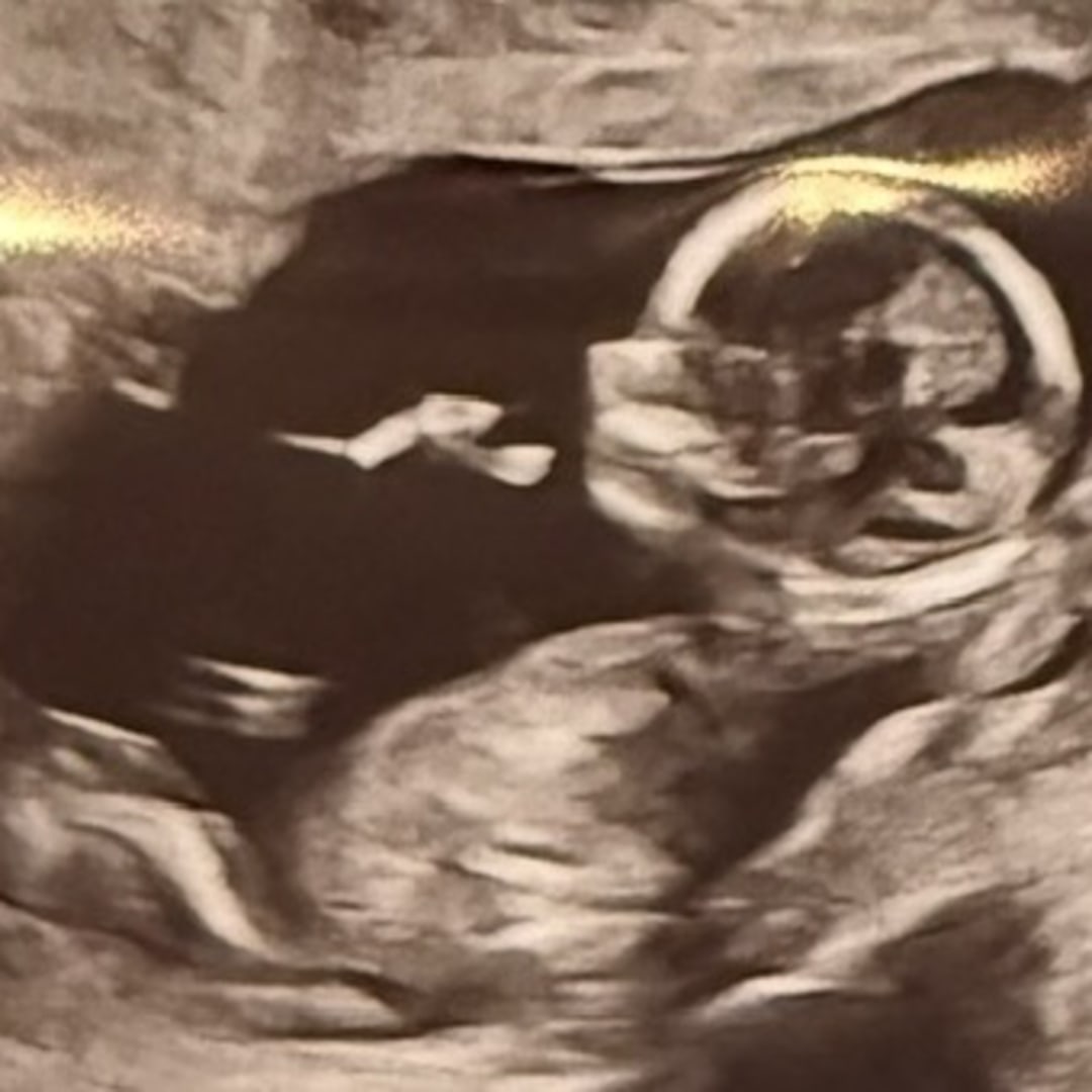 Photo shared by Karli for their Babylist baby registry.