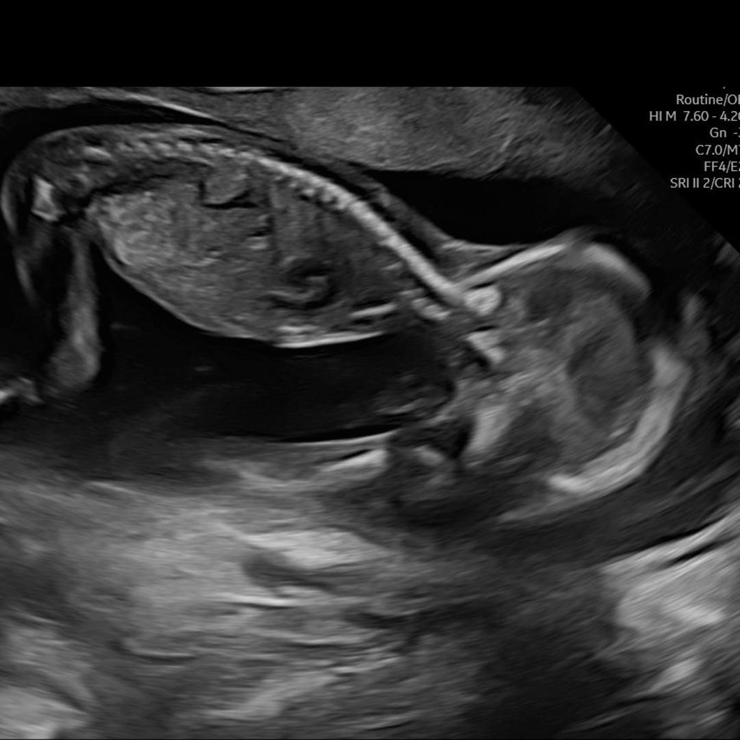 Photo shared by Makayla for their Babylist baby registry.