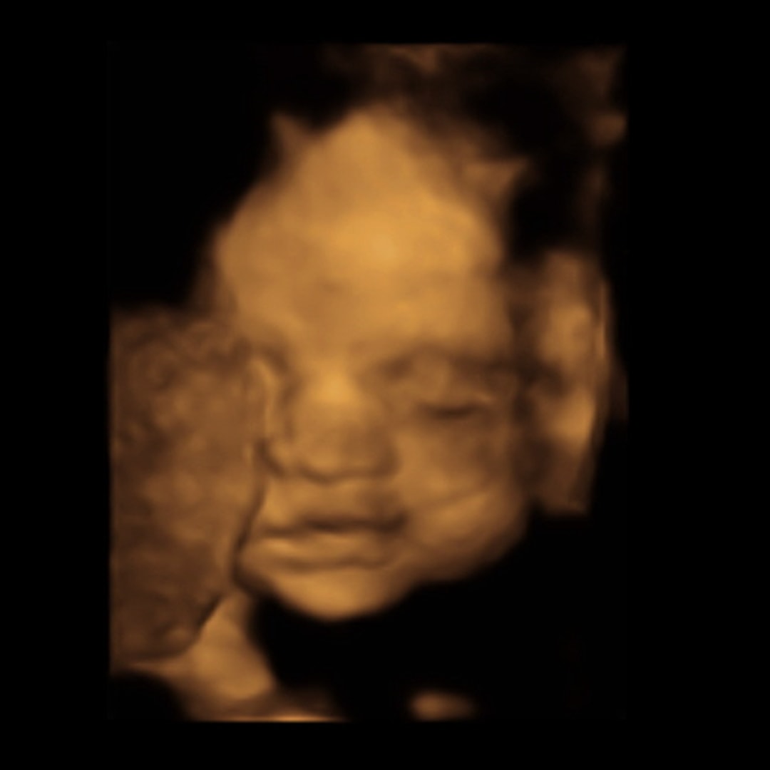Photo shared by Alexis for their Babylist baby registry.