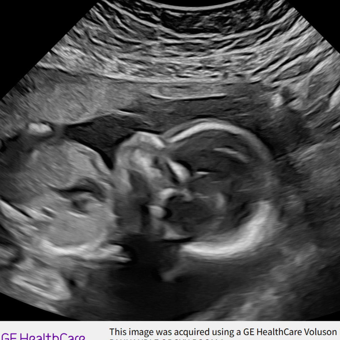 Photo shared by Courtney for their Babylist baby registry.