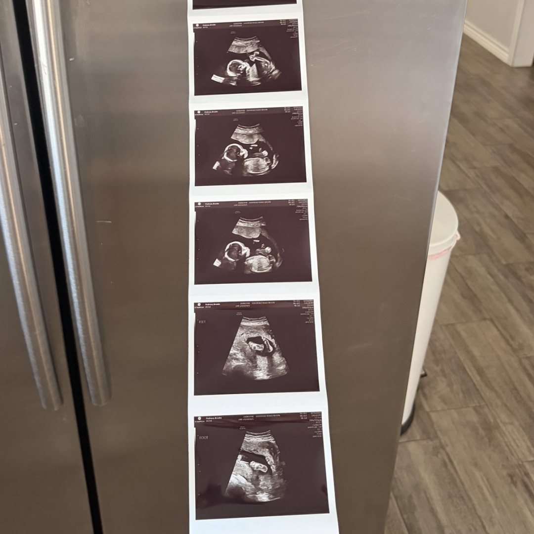 Photo shared by Brooke for their Babylist baby registry.