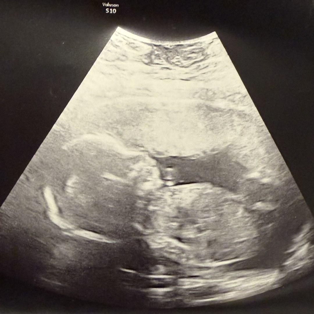 Photo shared by Breanna for their Babylist baby registry.