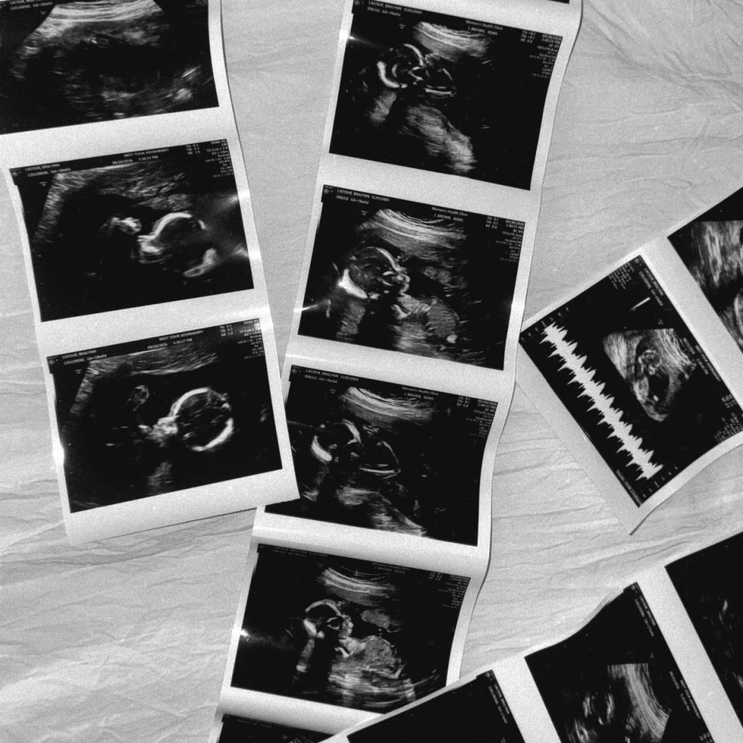 Photo shared by BraLynn for their Babylist baby registry.