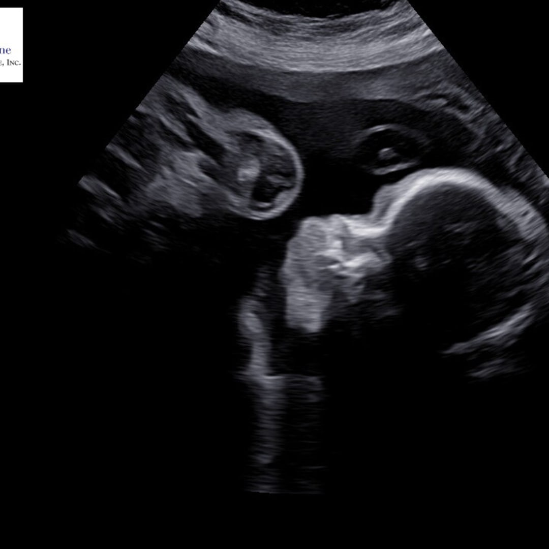 Photo shared by KIMBERLY for their Babylist baby registry.