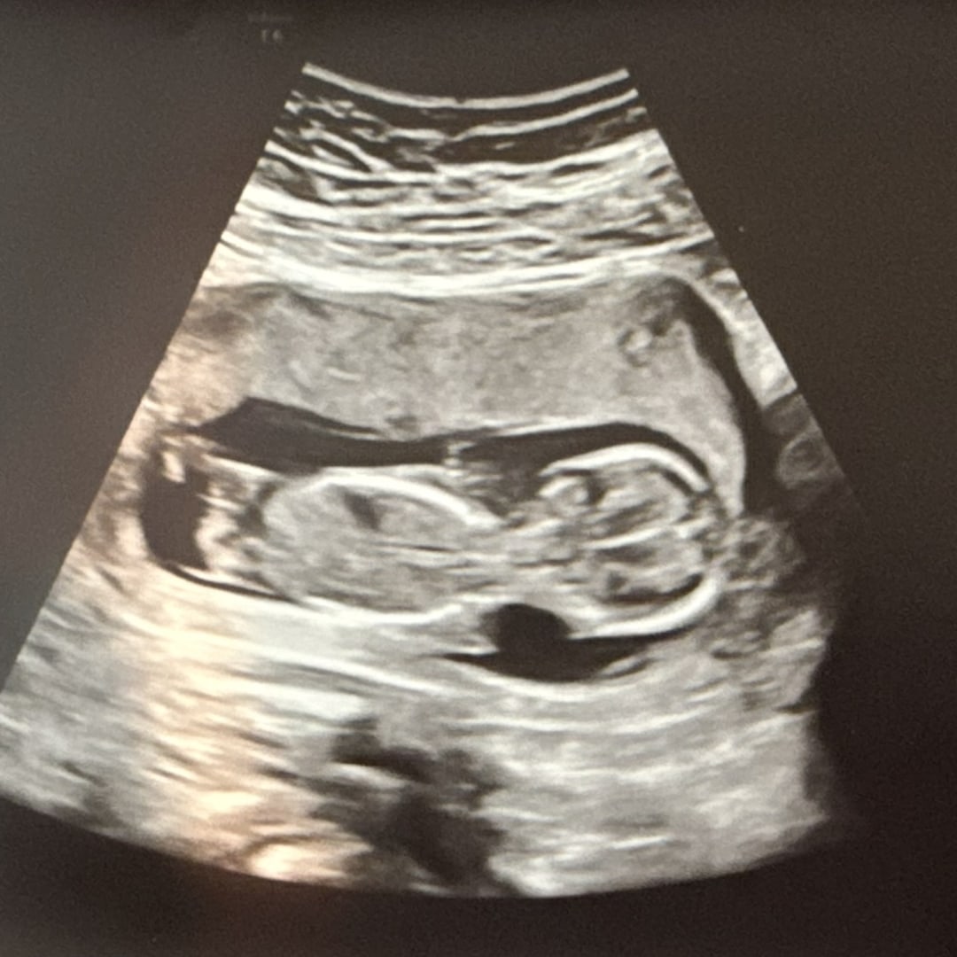 Photo shared by Montana for their Babylist baby registry.