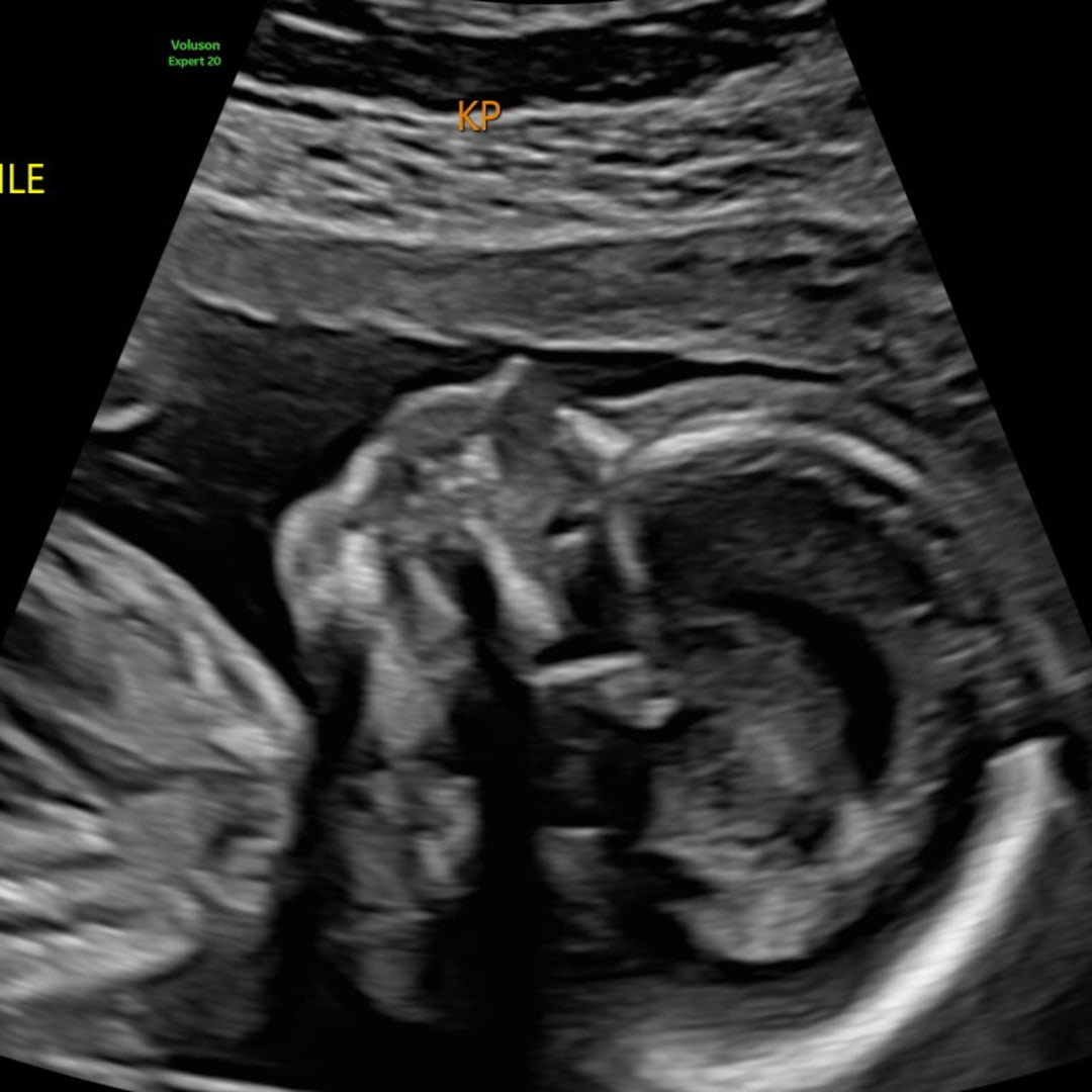 Photo shared by Grace for their Babylist baby registry.